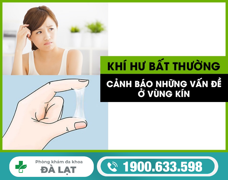 Hình ảnh minh họa